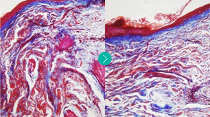 땡큐피부과 소프웨이브 POINT