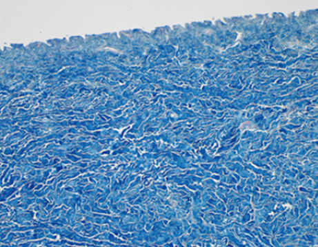 땡큐피부과 쥬브아셀