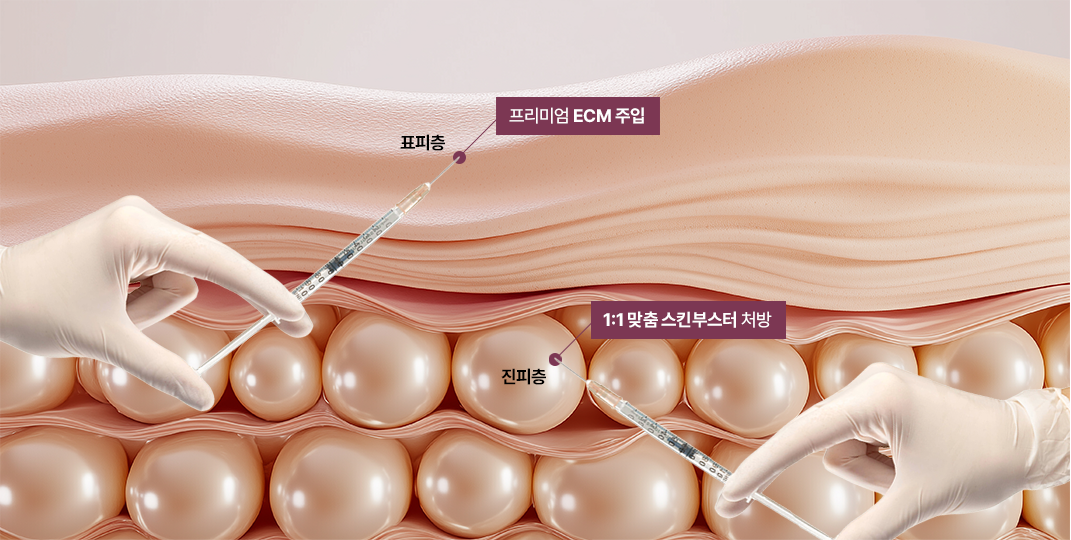 땡큐피부과 쥬브아셀